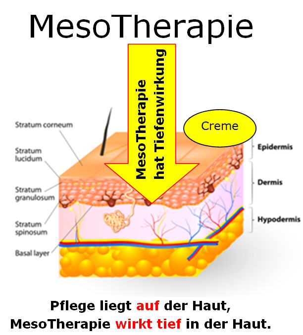 MesoTherapie